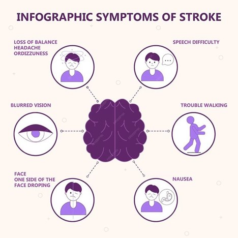 how to spot a stroke